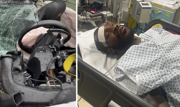 ФОТО. «Я был близок к смерти»: футболист рассказал шокирующие подробности Антонио, Ferrari, Полиция, Вест